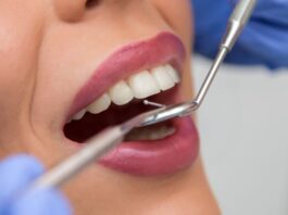 יישור שיניים מהיר